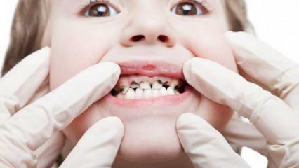 احصل على رعاية أسنان طفلك خلال الفصل الدراسي!