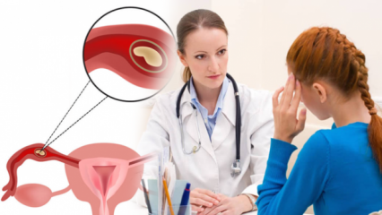 ما هو الحمل خارج الرحم (الحمل خارج الرحم) ، لماذا؟ ما هي علامات الحمل خارج الرحم؟