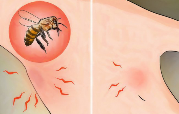 ما هي حساسية النحل وما هي الأعراض؟ طرق طبيعية جيدة لسعات النحل