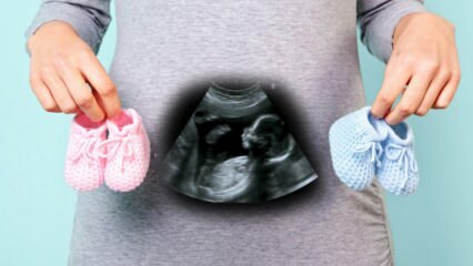 هل سيتم تحديد جنس الجنين في الأشهر الثلاثة الأولى من الحمل؟
