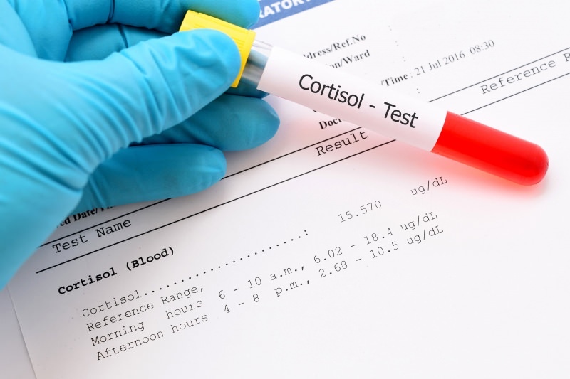 يحدث مستوى الكورتيزول في اختبارات الدم