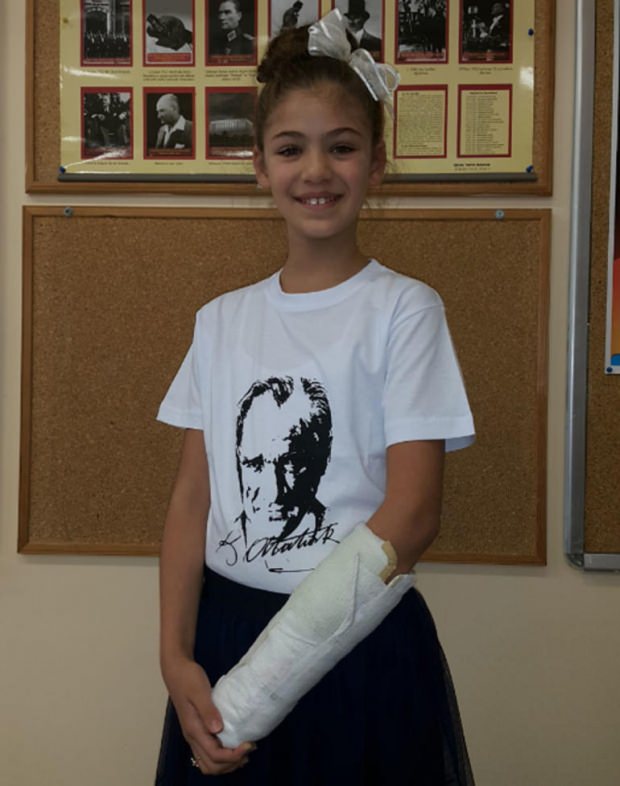تم كسر ذراع إيزابيلا داملا جوفن لكنها لم تغادر المجموعة