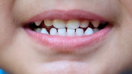 كيفية تعليم الأطفال رعاية الأسنان؟
