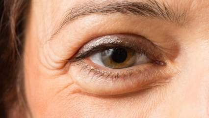 كيف تمر الانتفاخات تحت العينين؟ أفضل 10 كريمات لانتفاخات تحت العين