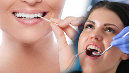 كيف تحافظ على صحة الفم والأسنان؟ ما الذي يجب مراعاته عند تنظيف الأسنان؟