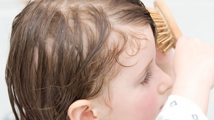 علاج قشرة الشعر عند الأطفال