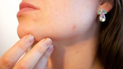ما هو سرطان الجلد (الميلانوما)؟ ما هي أعراض سرطان الجلد وهل هناك علاج؟