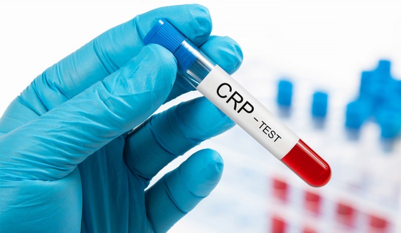 لماذا يرتفع بروتين سي التفاعلي في الدم؟ ما هو الـ CRP؟ كيف تخفض CRP؟