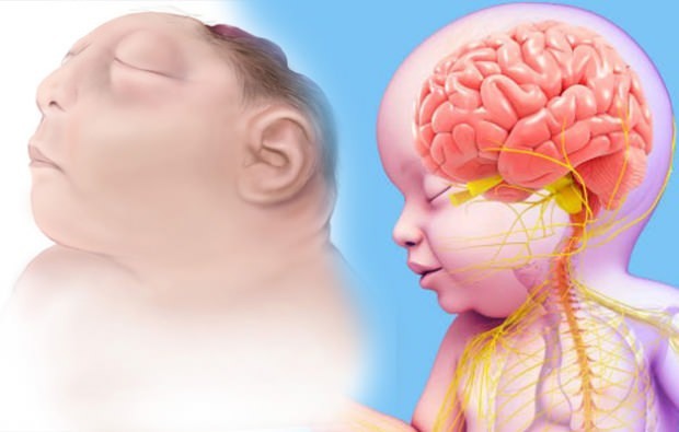 هل يعيش الطفل الرضيع؟ تشخيص الدماغ