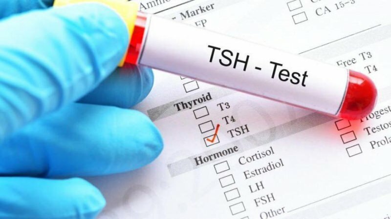 اختبار tsh هو اختبار هرمون
