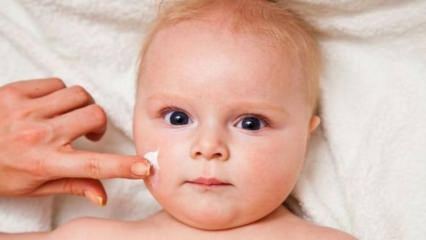 نصائح للعناية بالبشرة للأطفال! ما هي مشاكل الجلد عند الاطفال؟