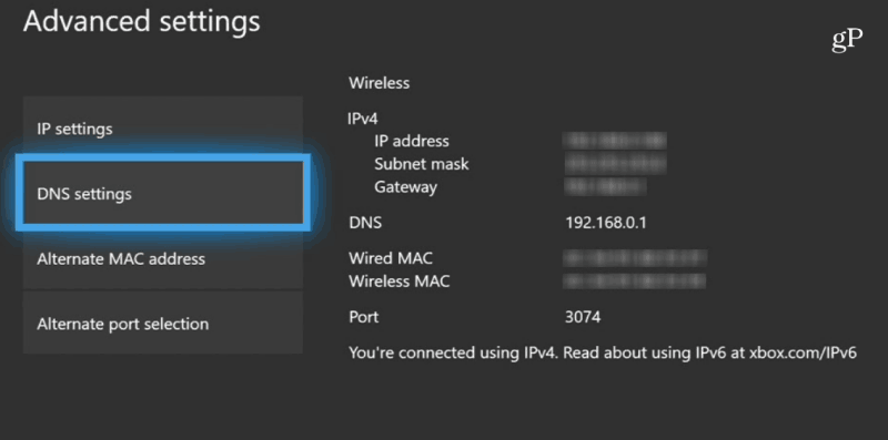 إعدادات Xbox One DNS
