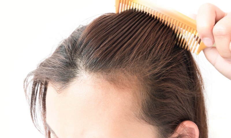 حلول تساقط الشعر بعد الولادة! ما هو جيد لتساقط الشعر؟