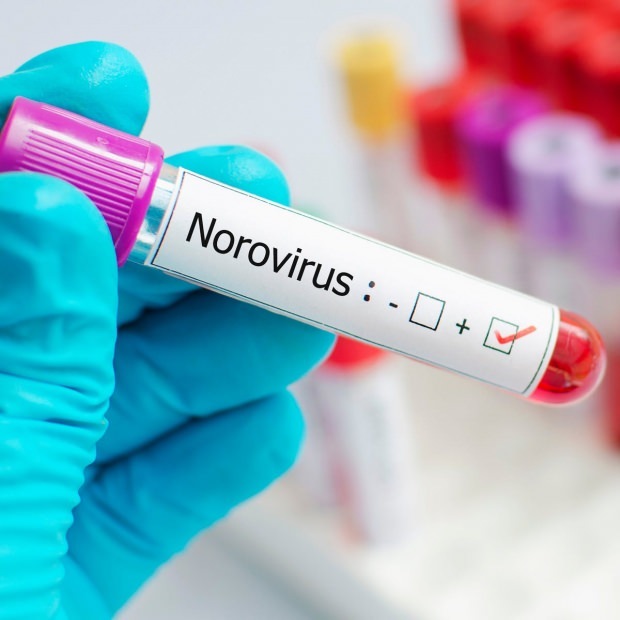 ما هو فيروس النوروفيروس وما يسببه من أمراض