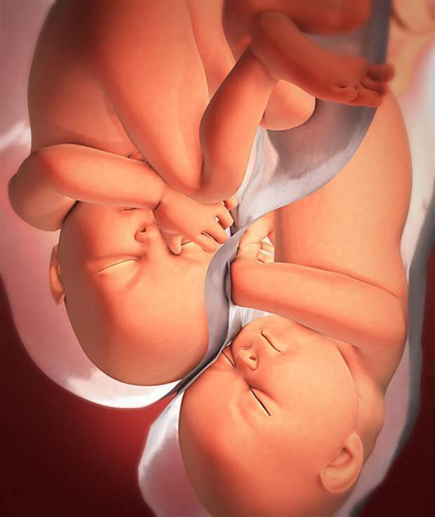 ما هي أعراض الحمل التوأم؟