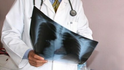 أعلن الخبراء! زيادة وفيات سرطان الرئة