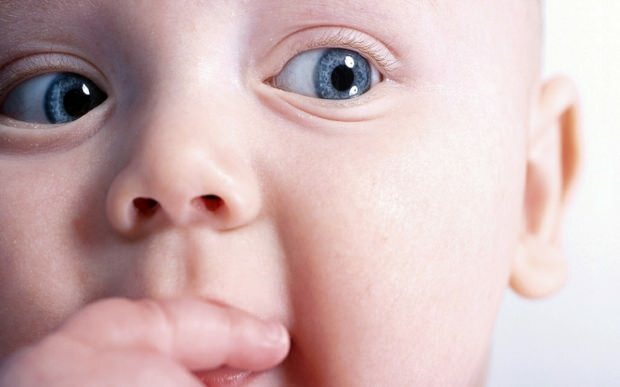 لماذا تحول العين عند الأطفال؟