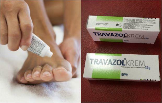 ماذا يفعل كريم travazol؟ كيف يتم استخدام كريم الترومول؟ سعر كريم Travazol