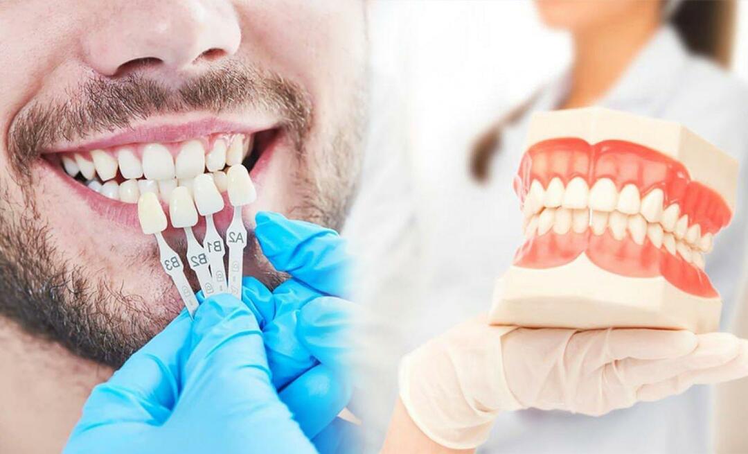 لماذا يتم تطبيق قشرة الزركونيوم على الأسنان؟ ما مدى متانة طلاء الزركونيوم؟