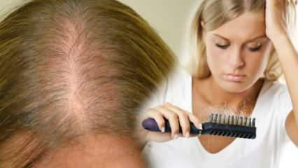 ما هي الطريقة الأكثر فعالية ضد تساقط الشعر؟ وصفات قناع يمنع تساقط الشعر