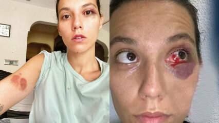 صور جديدة لدنيز بولوتسوز تتعرض للضرب من قبل أوزان جوفين!