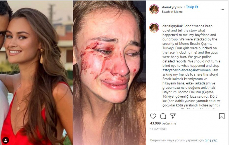 داريا كيريليوك عارضة الأزياء التي تعرضت للضرب في إزمير تشيشمي أصيبت بفيروس كورونا!