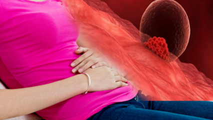 ما هو نزيف الانغراس أثناء الحمل؟ كيفية التمييز بين نزيف التنسيب ونزيف الحيض