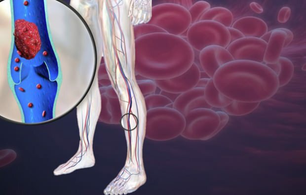 انخفاض الدورة الدموية في عروق الساق يسبب الألم